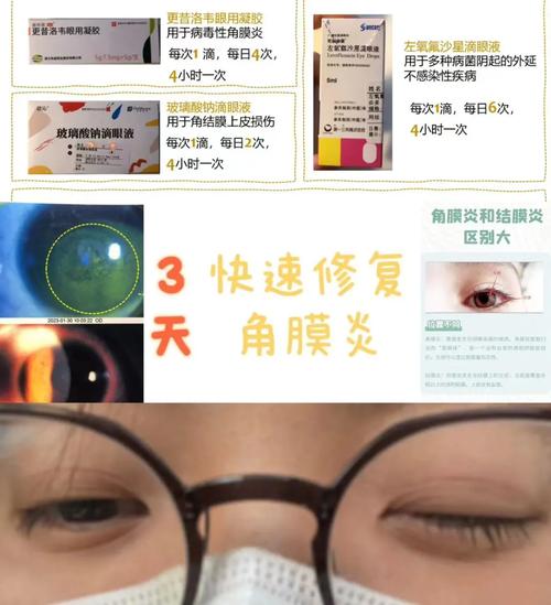 角膜炎如何刺络放血「眼球细菌感染需要摘除眼球吗」 明星娱乐